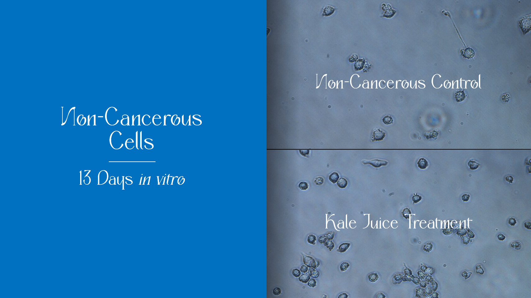  PowerPoint slide from Bilal Qizilbash's 2021 VQuad presentation illustrating a comparison of the impact of curly kale juice on non-cancerous cells after 13 days in vitro.